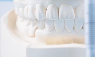 Nahaufnahme eines weißen Zahnmodells mit vollständigem Gebiss, verwendet zur Veranschaulichung von Zahnanatomie oder zur Planung zahnmedizinischer Behandlungen.